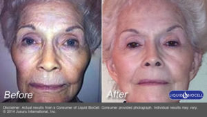 Thera, before and after photo, using liquid biocell, helps with collagen, hyaluranic acid, joints, mobility,  made from chicken cartilage, all natural,  